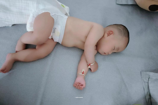 顺德宝宝头上长痱子